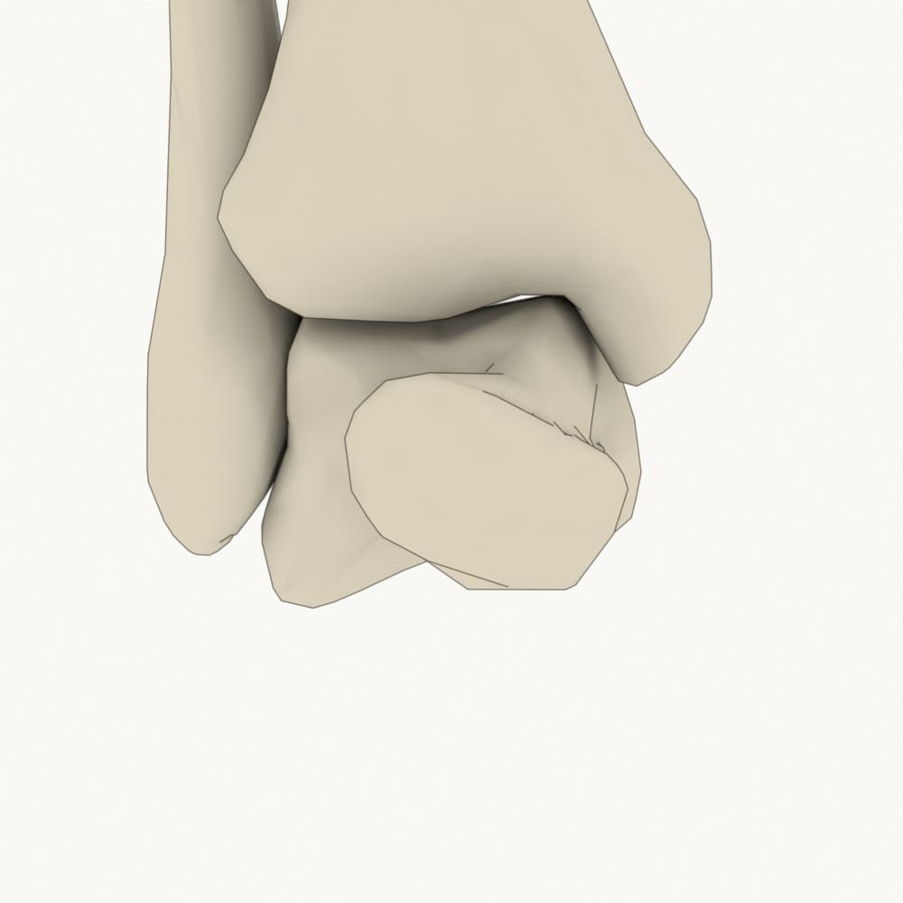 Malleolengabel frontal mit OSG-Achse